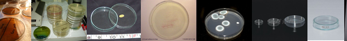 [Petri dish] ペトリ皿, ペトリさら, ペトリざら